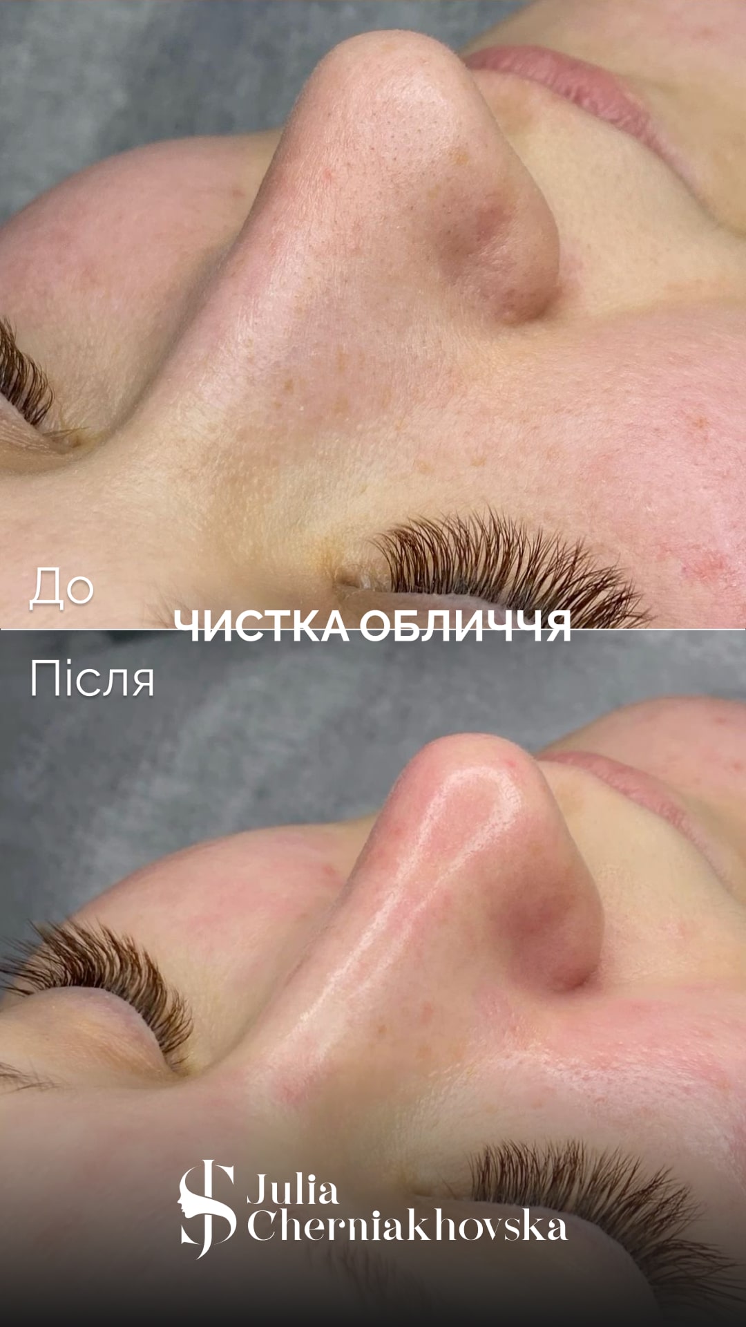 <span>Результати</span> 5